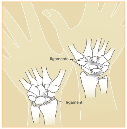 Wristsprains_image1